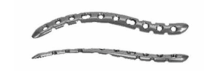 S-подібна блокуюча пластина для ключиці UMP